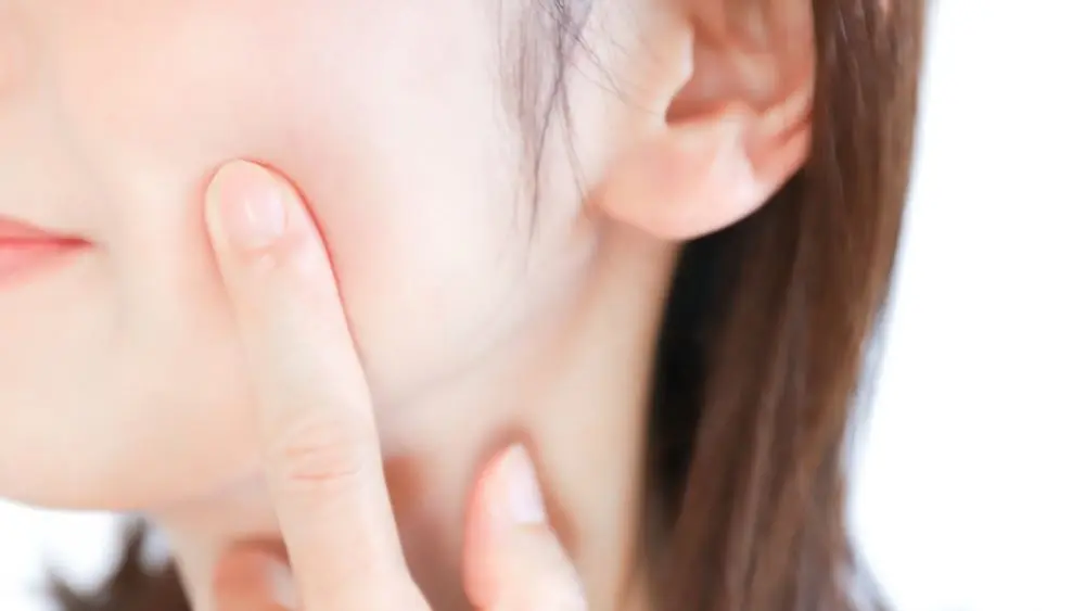 腸内環境が整い肌荒れが改善した女性