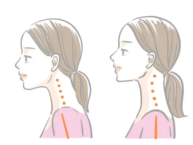 ストレートネックの女性イラスト
