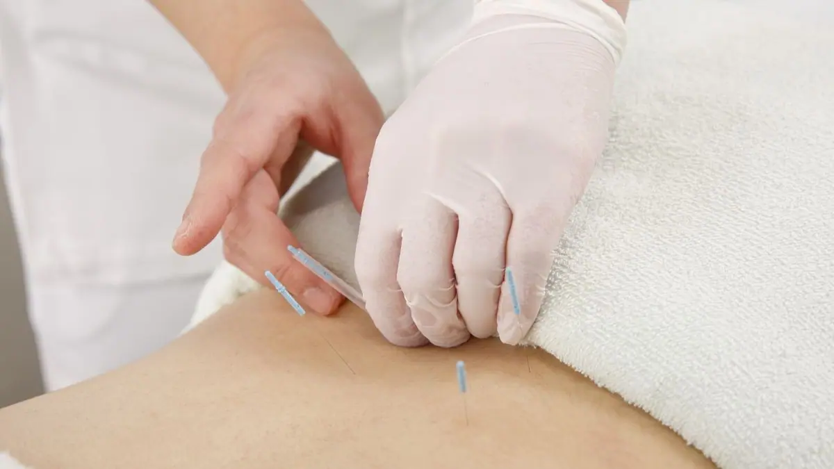 鍼灸師の仕事風景